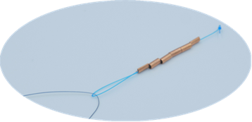 节育器生产厂家娜姆图片