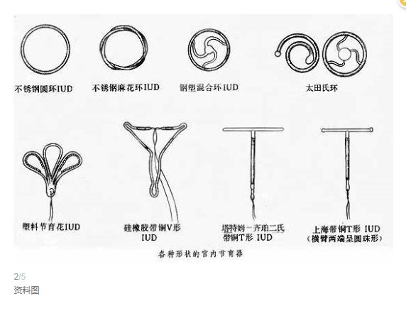 女性避孕选择哪类节育环比较舒适安全？